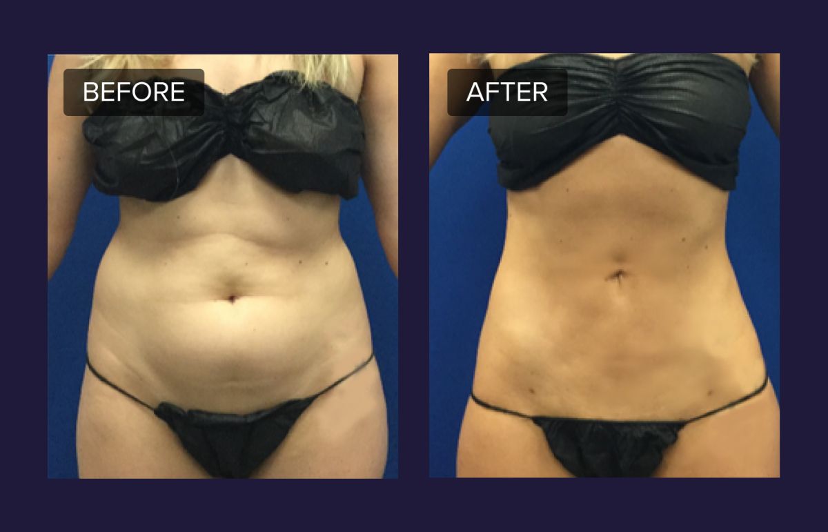 Laser & Aesthetic Technologies