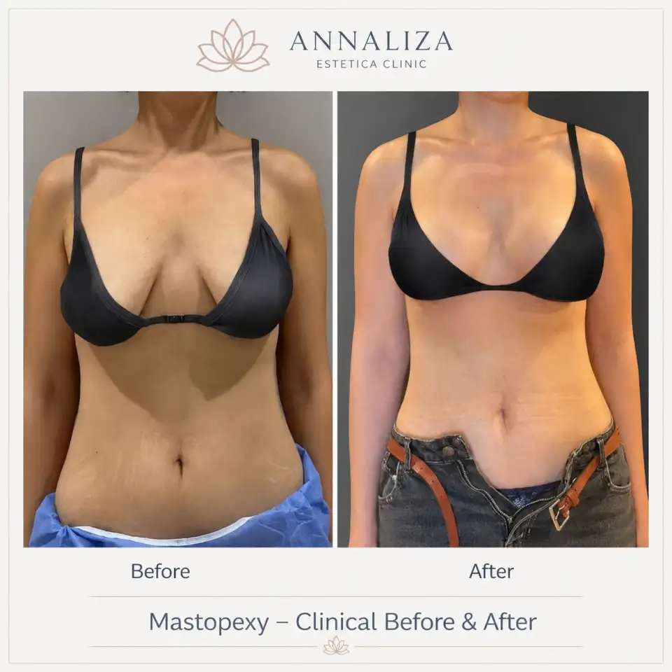 Plastic & Cosmetic Procedures treatment result at Annaliza Estetica Clinic Islamabad