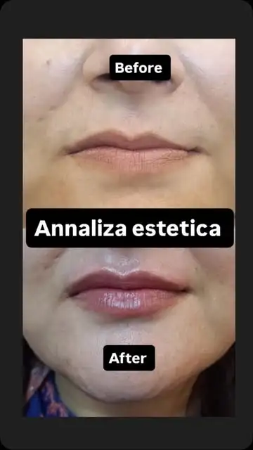 Before and after treatment result