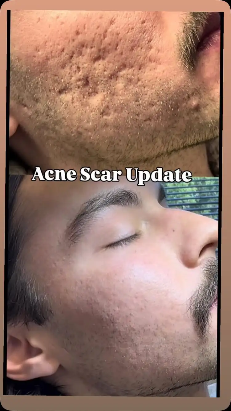 Before and after treatment result