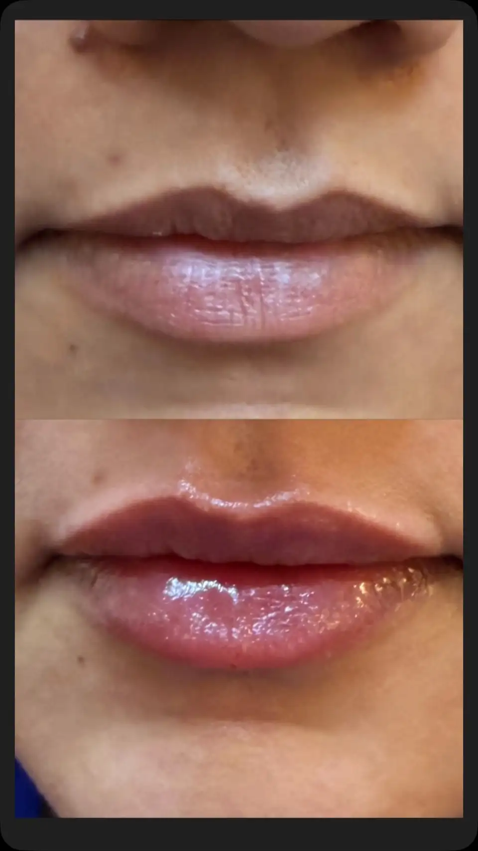 Before and after treatment result